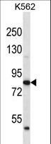 ABTB2 Antibody - ABTB2 Antibody western blot of K562 cell line lysates (35 ug/lane). The ABTB2 antibody detected the ABTB2 protein (arrow).