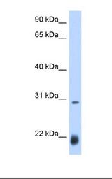 ac / Achaete Antibody - Drosophila cell lysate. Antibody concentration: 0.25 ug/ml. Gel concentration: 12%.  This image was taken for the unconjugated form of this product. Other forms have not been tested.