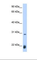 ac / Achaete Antibody - Drosophila cell lysate. Antibody concentration: 0.25 ug/ml. Gel concentration: 12%.  This image was taken for the unconjugated form of this product. Other forms have not been tested.