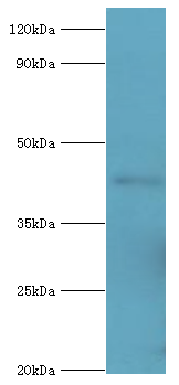 ACAA1 Antibody - Western blot. All lanes: 3-ketoacyl-CoA thiolase, peroxisomal antibody at 8 ug/ml+mouse liver tissue. Secondary antibody: Goat polyclonal to rabbit at 1:10000 dilution. Predicted band size: 44 kDa. Observed band size: 44 kDa.