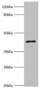 ACAA1 Antibody - Western blot All lanes: 3-ketoacyl-CoA thiolase, peroxisomal antibody at 8µg/ml + Mouse liver tissue Secondary Goat polyclonal to rabbit IgG at 1/10000 dilution Predicted band size: 45, 35 kDa Observed band size: 45 kDa