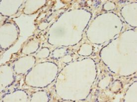 ACAA1 Antibody - Immunohistochemistry of paraffin-embedded human thyroid tissue gland using antibody at 1:100 dilution.  This image was taken for the unconjugated form of this product. Other forms have not been tested.