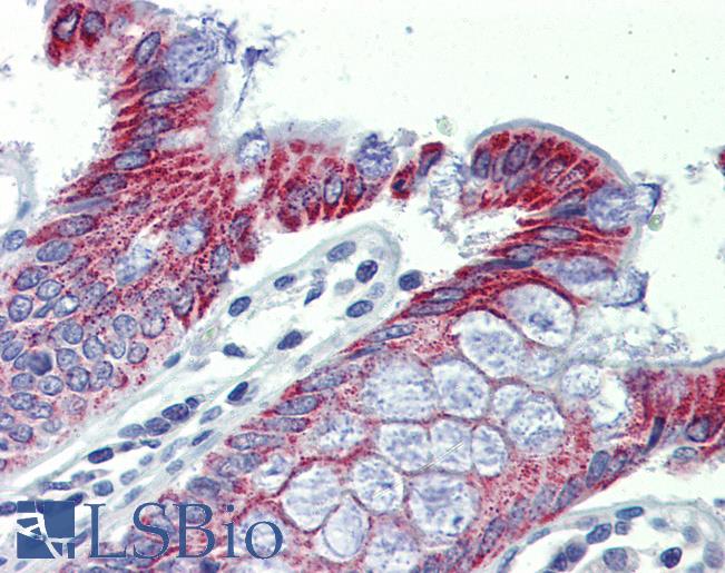 ACAA1 Antibody - Anti-ACAA1 antibody IHC of human colon. Immunohistochemistry of formalin-fixed, paraffin-embedded tissue after heat-induced antigen retrieval. Antibody concentration 5 ug/ml.  This image was taken for the unconjugated form of this product. Other forms have not been tested.