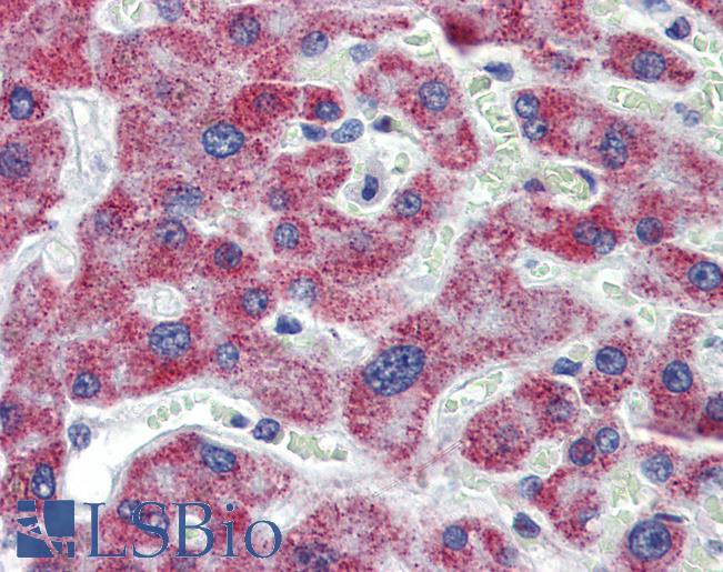 ACAA1 Antibody - Anti-ACAA1 antibody IHC of human liver. Immunohistochemistry of formalin-fixed, paraffin-embedded tissue after heat-induced antigen retrieval. Antibody concentration 5 ug/ml.  This image was taken for the unconjugated form of this product. Other forms have not been tested.