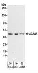 ACAA1 Antibody - Detection of Human ACAA1 by Western Blot. Samples: Whole cell lysate (50 ug) from HeLa, 293T, and Jurkat cells. Antibodies: Affinity purified rabbit anti-ACAA1 antibody used for WB at 0.1 ug/ml. Detection: Chemiluminescence with an exposure time of 3 minutes.