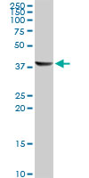 ACAA1 Antibody - ACAA1 monoclonal antibody (M01), clone 3F11. Western blot of ACAA1 expression in human liver.