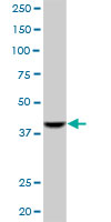 ACAA1 Antibody - ACAA1 monoclonal antibody (M01), clone 3F11. Western blot of ACAA1 expression in HepG2.