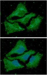 ACAA1 Antibody - ICC/IF analysis of ACAA1 in HeLa cells line, stained with DAPI (Blue) for nucleus staining and monoclonal anti-human ACAA1 antibody (1:100) with goat anti-mouse IgG-Alexa fluor 488 conjugate (Green).