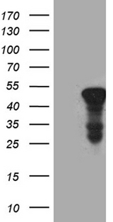 ACAA1 Antibody - HEK293T cells were transfected with the pCMV6-ENTRY control. (Left lane) or pCMV6-ENTRY ACAA1. (Right lane) cDNA for 48 hrs and lysed