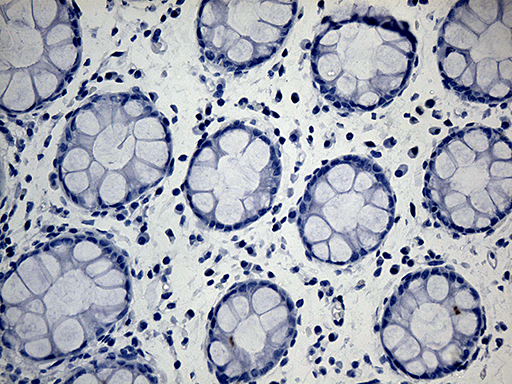 ACAA1 Antibody - Immunohistochemical staining of paraffin-embedded Human colon tissue within the normal limits using anti-ACAA1 mouse monoclonal antibody. This figure shows negative staining. (Heat-induced epitope retrieval by 1mM EDTA in 10mM Tris buffer. (pH8.5) at 120°C for 3 min. (1:500)