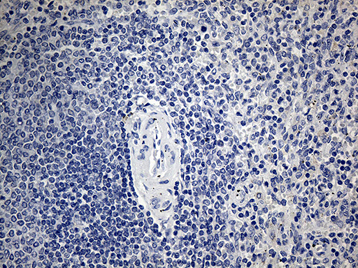 ACAA1 Antibody - Immunohistochemical staining of paraffin-embedded Human spleen tissue within the normal limits using anti-ACAA1 mouse monoclonal antibody. This figure shows negative staining. (Heat-induced epitope retrieval by 1mM EDTA in 10mM Tris buffer. (pH8.5) at 120°C for 3 min. (1:500)