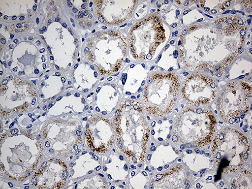 ACAA1 Antibody - Immunohistochemical staining of paraffin-embedded Human Kidney tissue within the normal limits using anti-ACAA1 mouse monoclonal antibody. (Heat-induced epitope retrieval by 1mM EDTA in 10mM Tris buffer. (pH8.5) at 120°C for 3 min. (1:500)