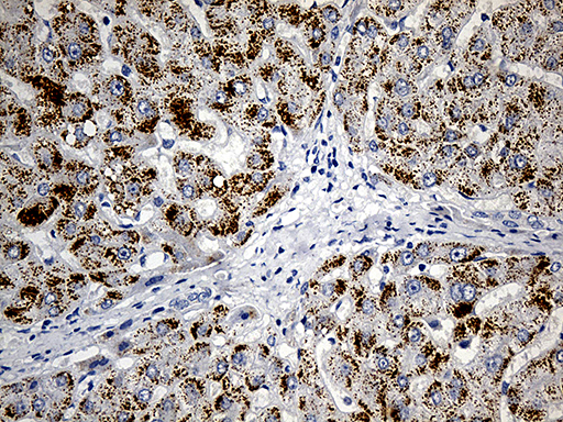 ACAA1 Antibody - Immunohistochemical staining of paraffin-embedded Human liver tissue within the normal limits using anti-ACAA1 mouse monoclonal antibody. (Heat-induced epitope retrieval by 1mM EDTA in 10mM Tris buffer. (pH8.5) at 120°C for 3 min. (1:500)