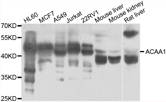 ACAA1 Antibody - Western blot analysis of extracts of various cell lines.