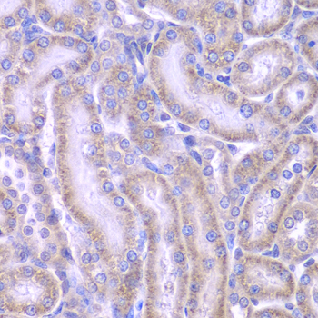 ACAA1 Antibody - Immunohistochemistry of paraffin-embedded rat kidney tissue.