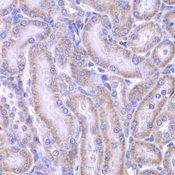 ACAA1 Antibody - Immunohistochemistry of paraffin-embedded rat kidney tissue.