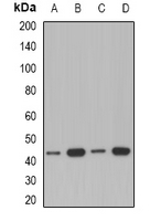 ACAA1 Antibody - Western blot analysis of ACAA1 expression in A549 (A); Jurkat (B); mouse kidney (C); rat liver (D) whole cell lysates.