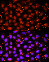 ACAA1 Antibody - Immunofluorescence analysis of HeLa cells using ACAA1 antibody at dilution of 1:100 (40x lens). Blue: DAPI for nuclear staining.