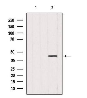 ACAA1 Antibody - Western blot analysis of extracts of 3T3 cells using ACAA1 antibody. Lane 1 was treated with the blocking peptide.