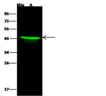 ACAA1 Antibody - Anti-ACAA1 rabbit polyclonal antibody at 1:500 dilution. Lane A: HepG2 Whole Cell Lysate. Lysates/proteins at 30 ug per lane. Secondary: Goat Anti-Rabbit IgG H&L (Dylight 800) at 1/10000 dilution. Developed using the Odyssey technique. Performed under reducing conditions. Predicted band size: 44 kDa. Observed band size: 44 kDa.