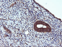 ACAA2 Antibody - IHC of paraffin-embedded Human endometrium tissue using anti-ACAA2 mouse monoclonal antibody, at a dilution of 1:150.