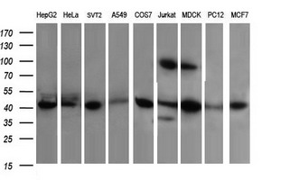 ACAA2 Antibody - Western blot of extracts (35 ug) from 9 different cell lines by using anti-ACAA2 monoclonal antibody (HepG2: human; HeLa: human; SVT2: mouse; A549: human; COS7: monkey; Jurkat: human; MDCK: canine; PC12: rat; MCF7: human).