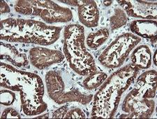 ACAA2 Antibody - IHC of paraffin-embedded Human Kidney tissue using anti-ACAA2 mouse monoclonal antibody.