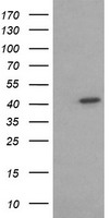 ACAA2 Antibody - HEK293T cells were transfected with the pCMV6-ENTRY control (Left lane) or pCMV6-ENTRY ACAA2 (Right lane) cDNA for 48 hrs and lysed. Equivalent amounts of cell lysates (5 ug per lane) were separated by SDS-PAGE and immunoblotted with anti-ACAA2.