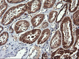 ACAA2 Antibody - IHC of paraffin-embedded Human Kidney tissue using anti-ACAA2 mouse monoclonal antibody.