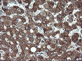 ACAA2 Antibody - IHC of paraffin-embedded Human liver tissue using anti-ACAA2 mouse monoclonal antibody.