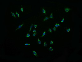 ACAA2 Antibody - Immunofluorescent staining of HeLa cells using anti-ACAA2 mouse monoclonal antibody.