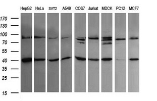 ACAA2 Antibody - Western blot of extracts (35ug) from 9 different cell lines by using anti-ACAA2 monoclonal antibody (HepG2: human; HeLa: human; SVT2: mouse; A549: human; COS7: monkey; Jurkat: human; MDCK: canine; PC12: rat; MCF7: human).