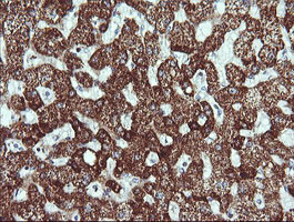ACAA2 Antibody - IHC of paraffin-embedded Human liver tissue using anti-ACAA2 mouse monoclonal antibody. (Heat-induced epitope retrieval by 10mM citric buffer, pH6.0, 120°C for 3min).
