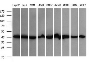 ACAA2 Antibody - Western blot of extracts (35 ug) from 9 different cell lines by using anti-ACAA2 monoclonal antibody (HepG2: human; HeLa: human; SVT2: mouse; A549: human; COS7: monkey; Jurkat: human; MDCK: canine; PC12: rat; MCF7: human).