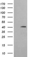 ACAA2 Antibody - HEK293T cells were transfected with the pCMV6-ENTRY control (Left lane) or pCMV6-ENTRY ACAA2 (Right lane) cDNA for 48 hrs and lysed. Equivalent amounts of cell lysates (5 ug per lane) were separated by SDS-PAGE and immunoblotted with anti-ACAA2.