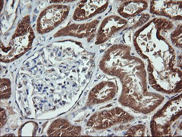 ACAA2 Antibody - IHC of paraffin-embedded Human Kidney tissue using anti-ACAA2 mouse monoclonal antibody.