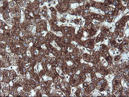 ACAA2 Antibody - IHC of paraffin-embedded Human liver tissue using anti-ACAA2 mouse monoclonal antibody.