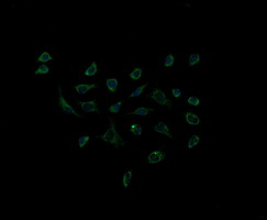 ACAA2 Antibody - Immunofluorescent staining of HeLa cells using anti-ACAA2 mouse monoclonal antibody.