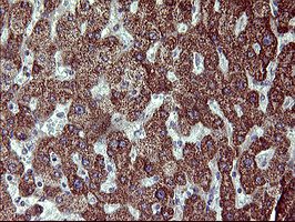 ACAA2 Antibody - IHC of paraffin-embedded Human liver tissue using anti-ACAA2 mouse monoclonal antibody. (Heat-induced epitope retrieval by 10mM citric buffer, pH6.0, 120°C for 3min).