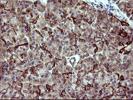 ACAA2 Antibody - IHC of paraffin-embedded Human pancreas tissue using anti-ACAA2 mouse monoclonal antibody. (Heat-induced epitope retrieval by 10mM citric buffer, pH6.0, 120°C for 3min).