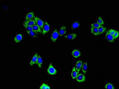 ACAA2 Antibody - Immunofluorescent analysis of HepG2 cells a at a dilution of 1:100 and Alexa Fluor 488-congugated AffiniPure Goat Anti-Rabbit IgG(H+L)