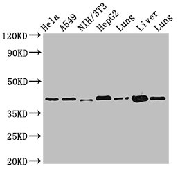 ACAA2 Antibody - Positive Western Blot detected in Hela whole cell lysate, A549 whole cell lysate, NIH/3T3 whole cell lysate, HepG2 whole cell lysate, Rat lung tissue, Mouse liver tissue, Mouse lung tissue. All lanes: ACAA2 antibody at 2.4 µg/ml Secondary Goat polyclonal to rabbit IgG at 1/50000 dilution. Predicted band size: 42 KDa. Observed band size: 42 KDa