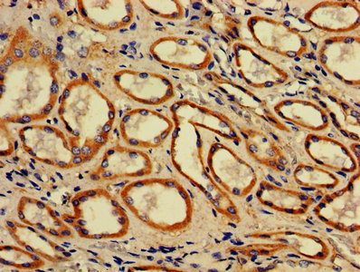 ACAA2 Antibody - IHC image of ACAA2 Antibody diluted at 1:700 and staining in paraffin-embedded human kidney tissue performed on a Leica BondTM system. After dewaxing and hydration, antigen retrieval was mediated by high pressure in a citrate buffer (pH 6.0). Section was blocked with 10% normal goat serum 30min at RT. Then primary antibody (1% BSA) was incubated at 4°C overnight. The primary is detected by a biotinylated secondary antibody and visualized using an HRP conjugated SP system.