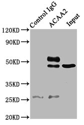 ACAA2 Antibody - Immunoprecipitating ACAA2 in A549 whole cell lysate Lane 1: Rabbit control IgG (1µg) instead of ACAA2 Antibody in A549 whole cell lysate.For western blotting, a HRP-conjugated Protein G antibody was used as the secondary antibody (1/2000) Lane 2: ACAA2 Antibody (6µg) + A549 whole cell lysate (500µg) Lane 3: A549 whole cell lysate (10µg)