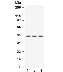 ACAA2 Antibody - Western blot testing of 1) rat lung, 2) mouse brain and 3) human HeLa lysate with ACAA2 antibody at 0.5ug/ml. Predicted molecular weight ~42 kDa.