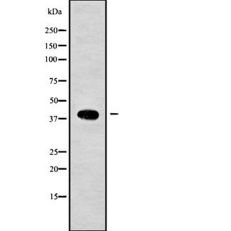 ACAA2 Antibody - Western blot analysis of ACAA2 using Jurkat whole cells lysates