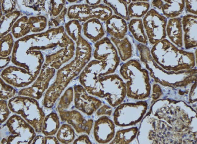 ACAA2 Antibody - 1:100 staining rat kidney tissue by IHC-P. The sample was formaldehyde fixed and a heat mediated antigen retrieval step in citrate buffer was performed. The sample was then blocked and incubated with the antibody for 1.5 hours at 22°C. An HRP conjugated goat anti-rabbit antibody was used as the secondary.