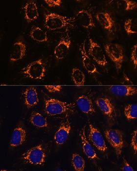 ACAA2 Antibody - Immunofluorescence analysis of U-2OS cells using ACAA2 Polyclonal Antibody at dilution of 1:100.Blue: DAPI for nuclear staining.