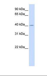 ACAA2 Antibody - Fetal liver lysate. Antibody concentration: 1.0 ug/ml. Gel concentration: 12%.  This image was taken for the unconjugated form of this product. Other forms have not been tested.