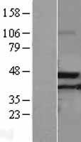 ACAA2 Protein - Western validation with an anti-DDK antibody * L: Control HEK293 lysate R: Over-expression lysate